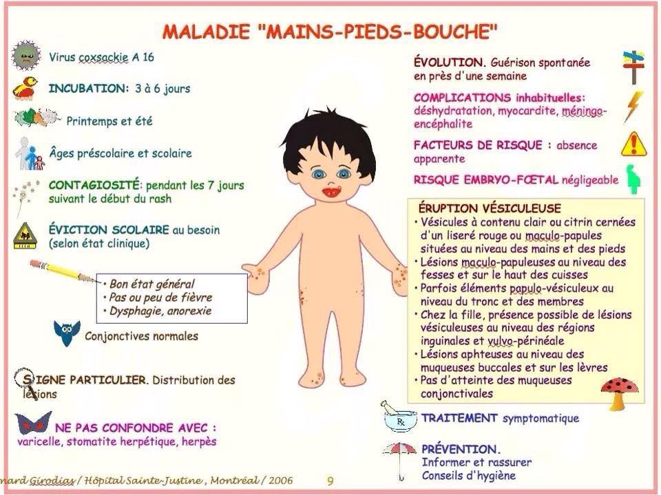 MALADIE MAINS-PIEDS-BOUCHE